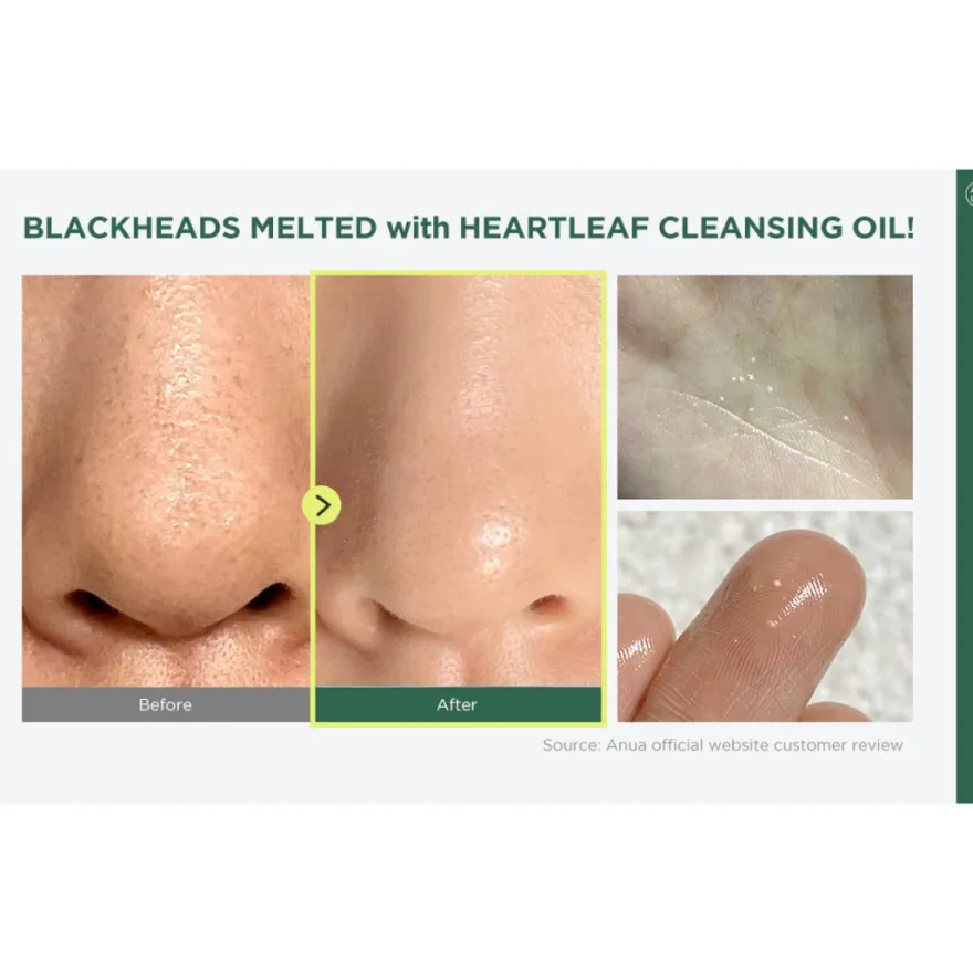 Anua Heartleaf Pore Control Aceite Limpiador 200ml