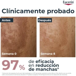 EUCERIN Anti-Pigment Dual Serum 30ml