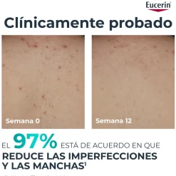 Eucerin DermoPure Clinical Crema Corporal Correctora 200 ml
