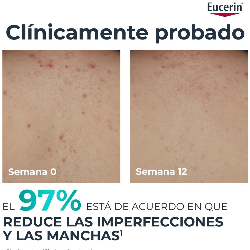 Eucerin DermoPure Clinical Crema Corporal Correctora 200 ml