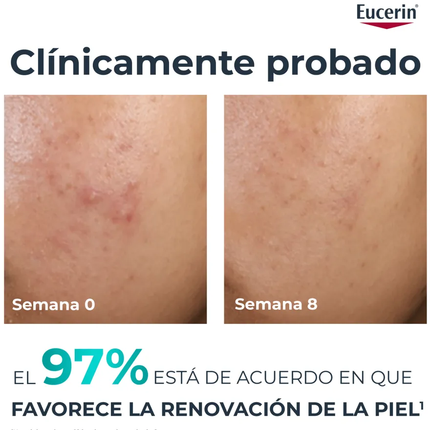 Eucerin DermoPure Clinical Peeling 10 40ml