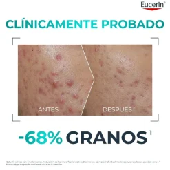 EUCERIN DermoPure Clinical PROBIOM8 Kit