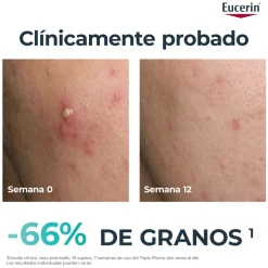 Eucerin DermoPure Clinical Serum Triple Action 40 ml