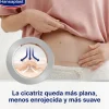 HANSAPLAST Reductor de Cicatrices 2x21 apósitos【PACK AHORRO】