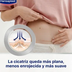 HANSAPLAST Reductor de Cicatrices 2x21 apósitos【PACK AHORRO】