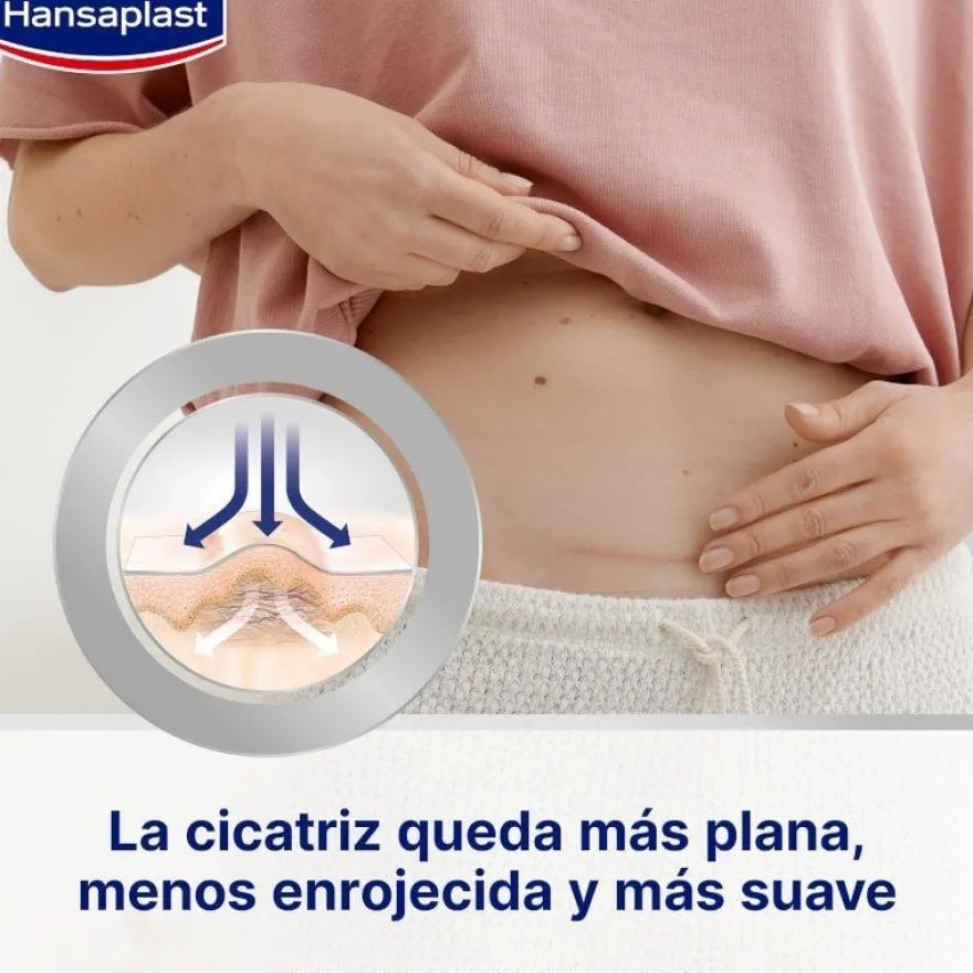 HANSAPLAST Reductor de Cicatrices 2x21 apósitos【PACK AHORRO】