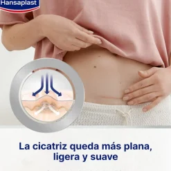 HANSAPLAST Reductor de Cicatrices XL 21 apósitos 146x30mm