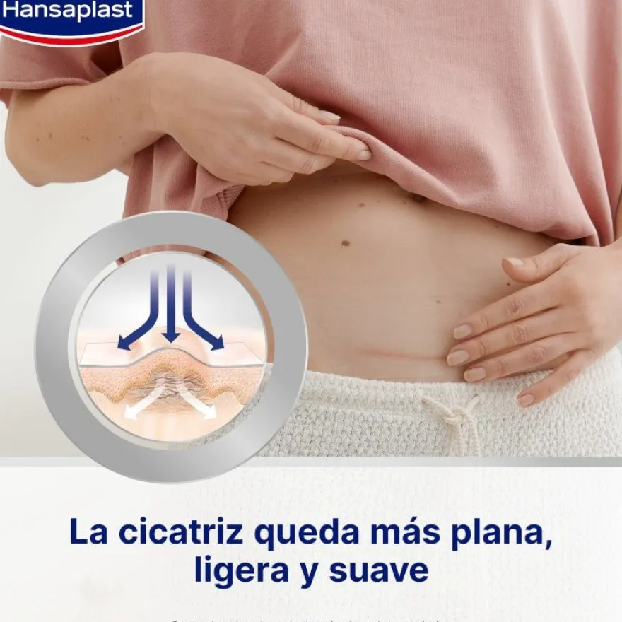 HANSAPLAST Reductor de Cicatrices XL 21 apósitos 146x30mm