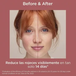 ISDIN FotoUltra Redness SPF 50+ (50ml)