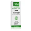 MARTIDERM Acniover Sérum 30ml