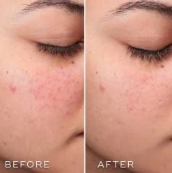 Medik8 Press & Clear 150 ml