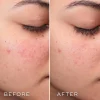 Medik8 Press & Clear Refill 150 ml