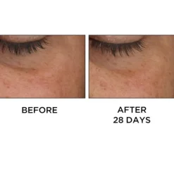 Perricone Cold Plasma Plus+ Eye 15 ml