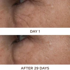 Perricone Cold Plasma Plus+ Eye 15 ml