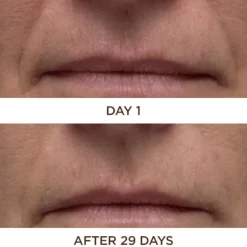 Perricone Cold Plasma Plus+ Face 30 ml