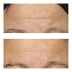 Perricone Cold Plasma Plus+ The Intensive Hydrating Complex 59 ml
