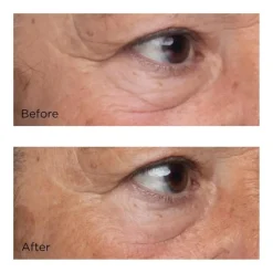 Perricone High Potency Growth Factor Firming & Lifting Eye Serum 15 ml