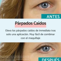 REMESCAR Párpados Caídos 8ml