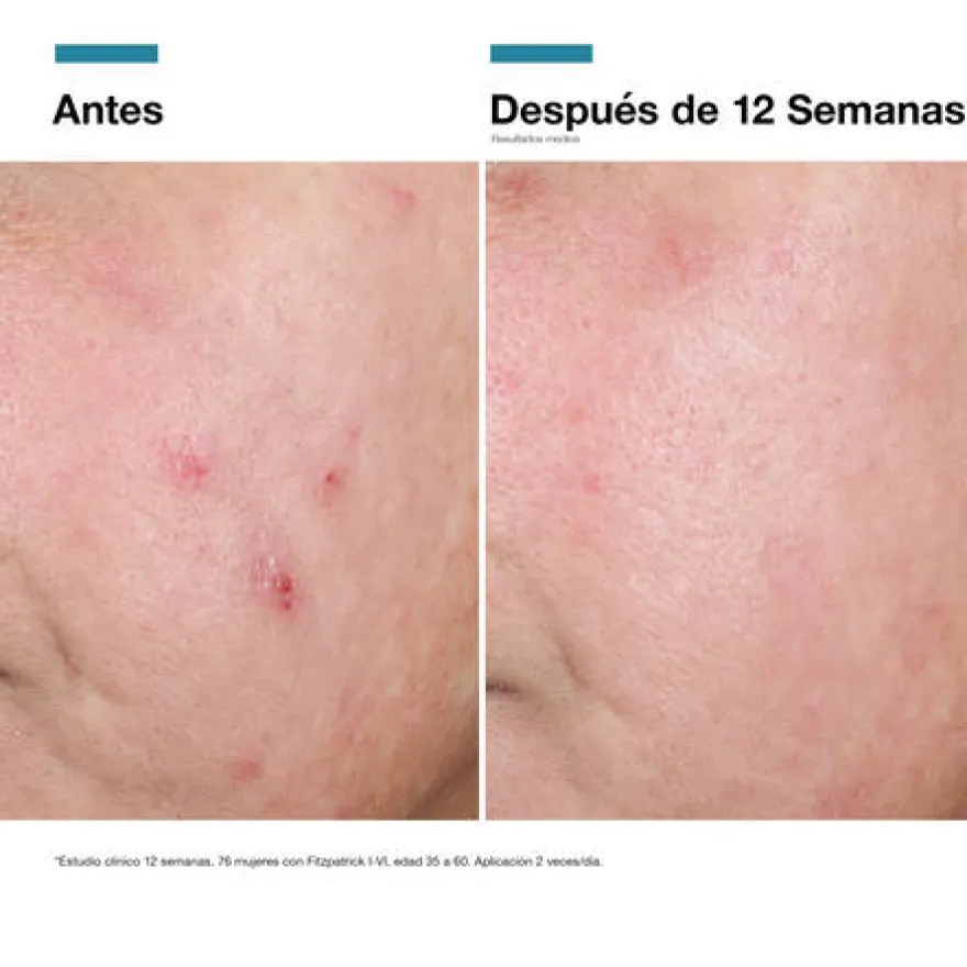 SkinCeuticals Advanced RGN 6 50ml