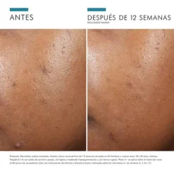SkinCeuticals Phyto A + 30ml