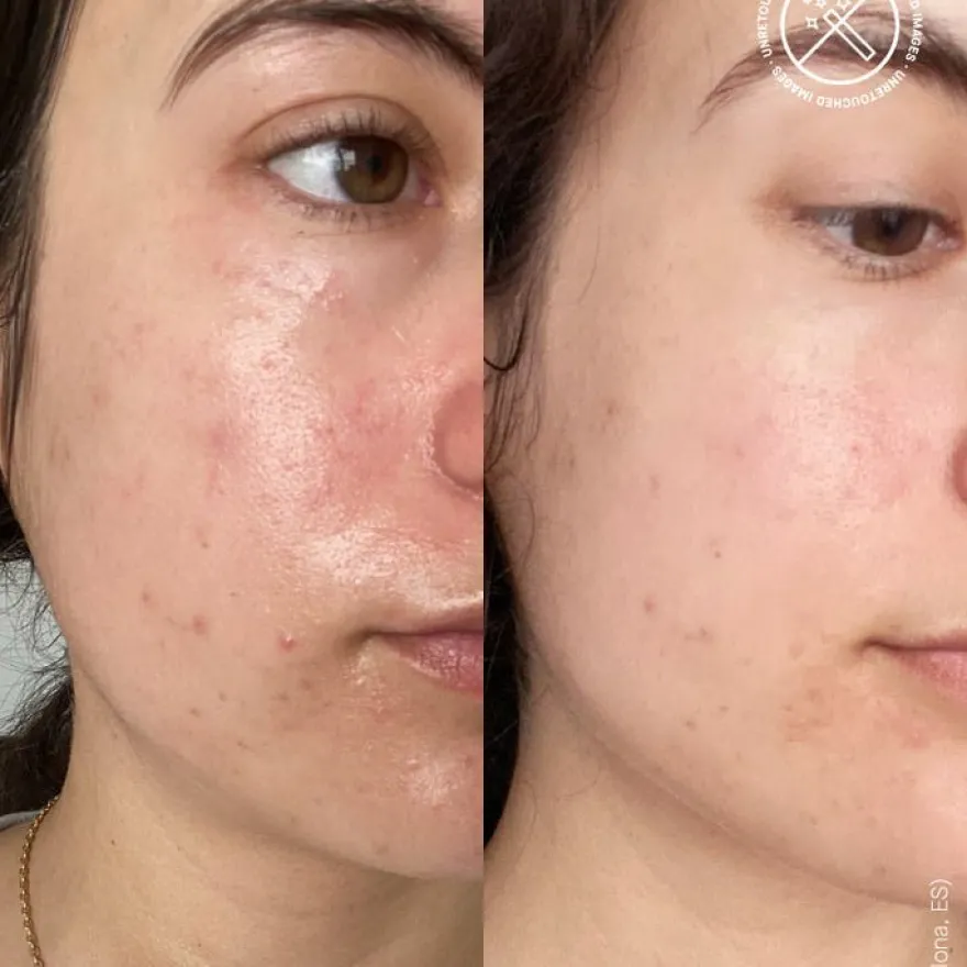 Transparent Lab Barrier Restoring Hydrating Cream 50ml