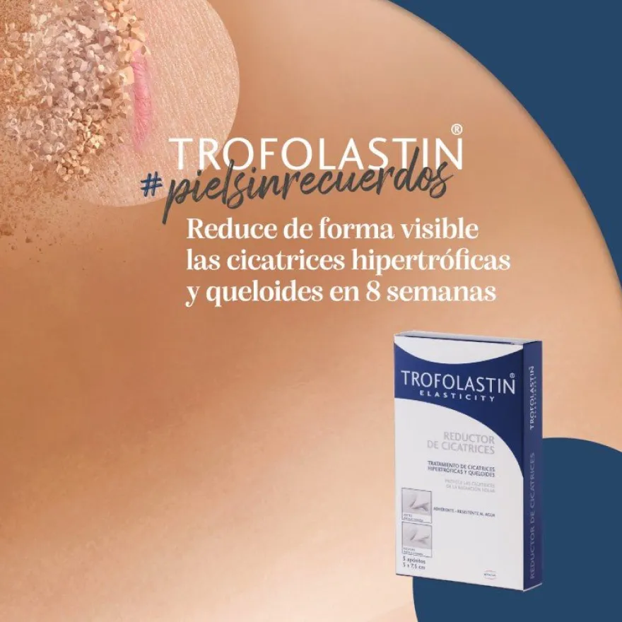TROFOLASTIN Reductor de Cicatrices Periareolar 3x2 parches