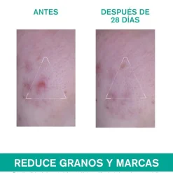 URIAGE Hyseac 3-Regul+ 40 ml