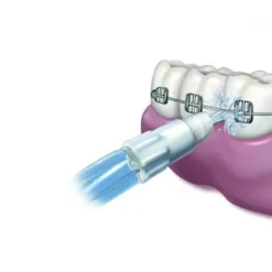 WATERPIK Recambio Boquilla Irrigador Orthodontic 2 uds